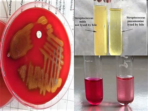 streptococcus pyogenes biochemical tests|BIOCHEMICAL TESTS FOR STREPTOCOCCUS .